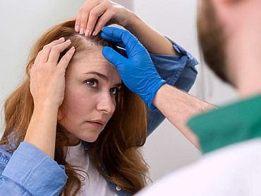 ¿Qué hacer para detener la caída del cabello en mujeres?